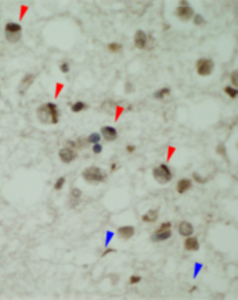 TDP-43_Figure1