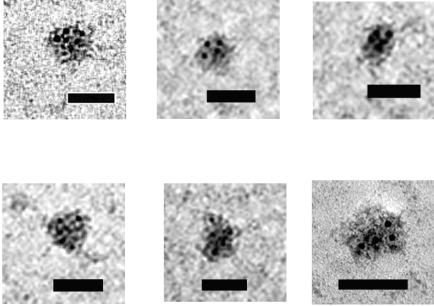 TDP-43_Figure2