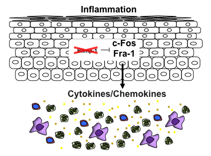 inflammation inflammation