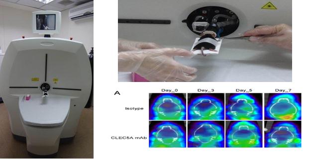 PET-CT diagram PET-CT diagram