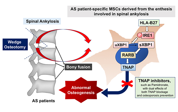 2019 AS Mystery-F1 AS patient-specific MSCs derived from the enthesis involved in spinal ankylosis 2019 AS Mystery-F1 AS patient-specific MSCs derived from the enthesis involved in spinal ankylosis